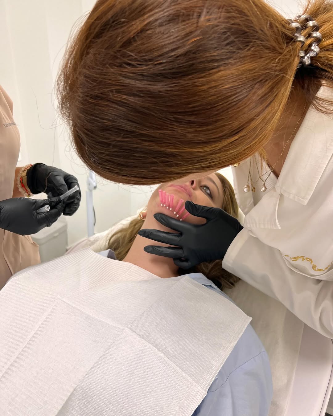 Hilos tensores clinica esmeralda gallego